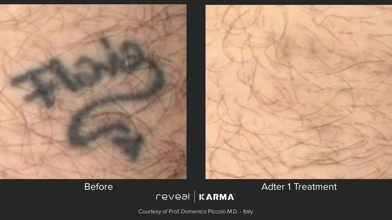 karma before and after 3